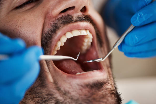Best Dentist for Severe Toothache  in Bellaire, TX